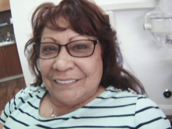55-64 year old woman treated with Dental Crown after 2916029
