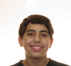 Severe Crowding and Overjet with Narrow Smile Treated Non-extraction with Braces 1932403