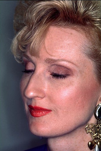 Rhinoplasty before 1023221