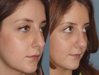 Female, Mid-20's before 827439