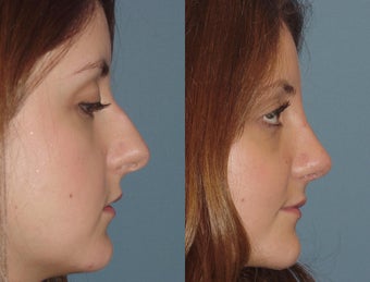 Female, Mid-20's after 827439