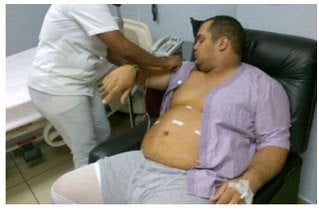 28 years male treated with sleeve gastrectomy before 1239517