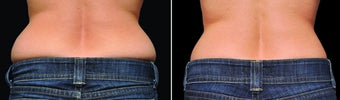 Before and After before 1196458