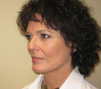 54 Year Old Seeks More Youthful Appearance 1475033