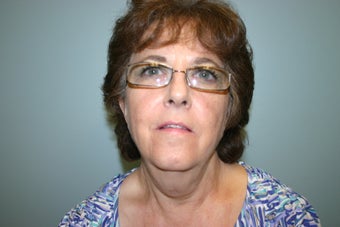 66 year old Female before 934277