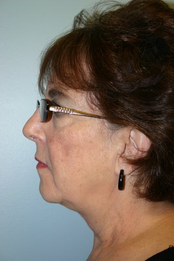 66 year old Female 934277