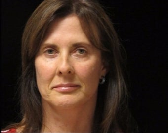 45-54 year old woman treated with Facelift after 2509162