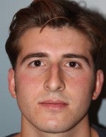 25-34 year old man treated with Rhinoplasty before 3103983