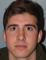 25-34 year old man treated with Rhinoplasty after 3103983