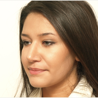 17 or under year old woman treated with Rhinoplasty after 3418738