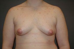 FTM Transgender before 1227458