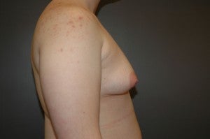 FTM Transgender 1227458