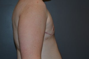 FTM Transgender 1227458