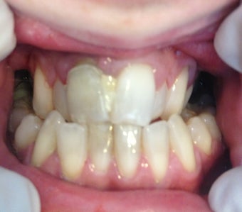 29 year old same day makeover . before 987087