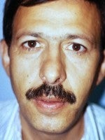 45-54 year old man treated with Rhinoplasty before 3104006