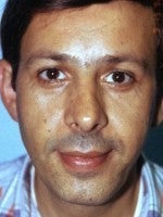 45-54 year old man treated with Rhinoplasty after 3104006