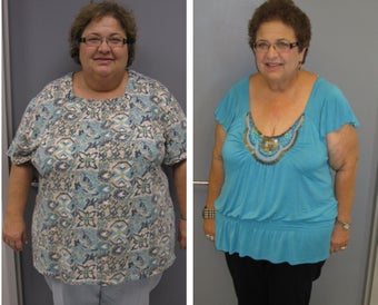Before & After before 1104616