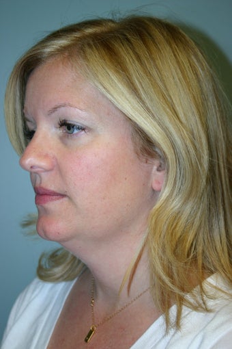38 year old Female 934402