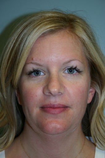 38 year old Female before 934402