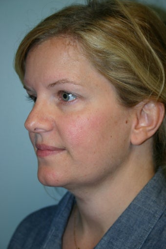 38 year old Female 934402