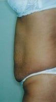 26 year old female patient 934729