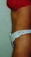 26 year old female patient 934729