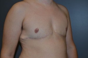FTM Transgender 1227241