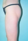 51 year old female patient 926960