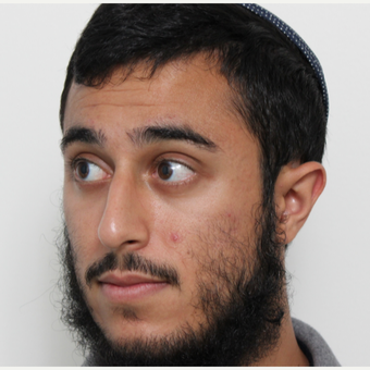 18-24 year old man treated with Rhinoplasty before 3448595
