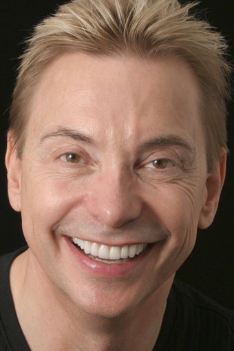 Porcelain Veneers after 423730