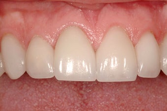 Cosmetic Dentistry after 209393