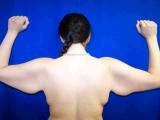 Arm Lift Surgery (Brachioplasty) before 146028