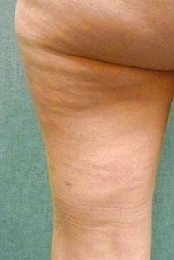 Cellulaze before 582367