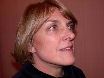 Facelift, Neck lift, Blepharoplasty after 182883