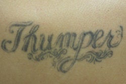 Laser Tattoo Removal before 203258