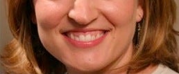 Botox for a gummy smile before 371663