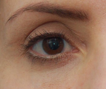 Artefill to the Orbital Rim before 270408