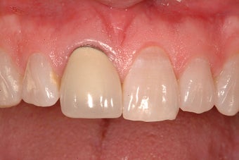 Cosmetic Dentistry before 209393