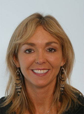 Botox after 260041