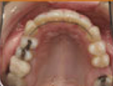Damon System Braces 477293