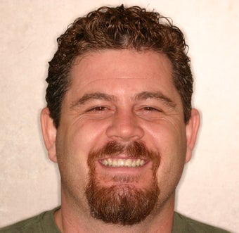 Smile Makeover before 345547