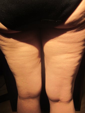 Cellulaze 589900