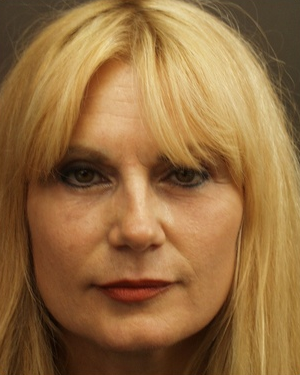 Blepharoplasty after 164763