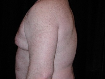 Cool Lipo 245621