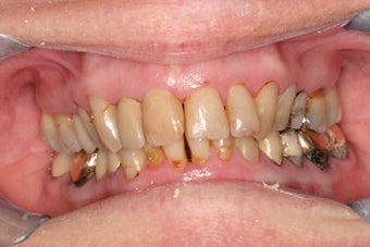 Smile makeover before 372755