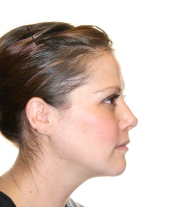 Surgical Orthodontics 344747