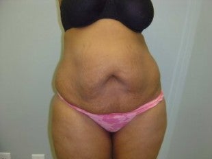 31 year old mother of 3 before 620894