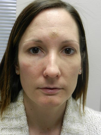 Before and After Skin Care before 635902