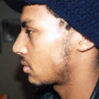 African American Rhinoplasty after 448652