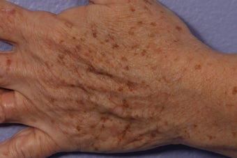 IPL Limelight to Hands before 309737